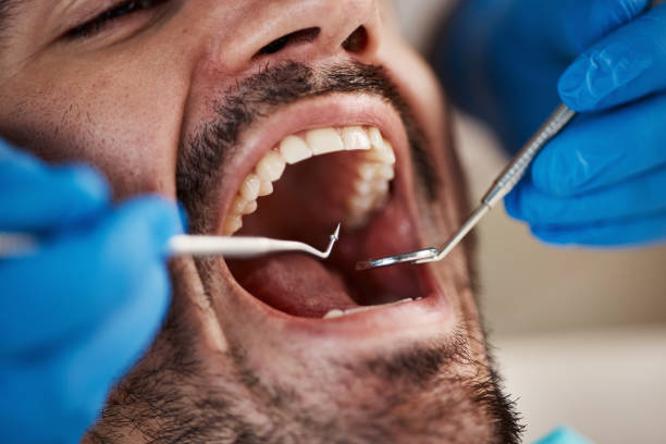 Emergency Dental Services in Eldorado, IL